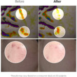 سرم تقویت‌کننده پوست MEDITHERAPY Retinal Skin Booster – رتینالدهید و نیاسینامید، ۱۵۰ میلی‌لیتر - Image 3
